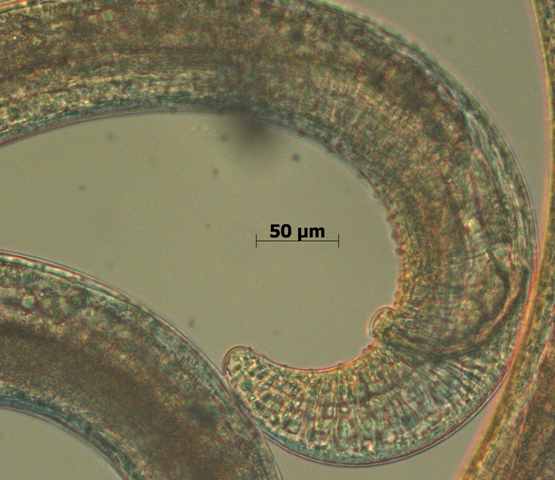 posterior