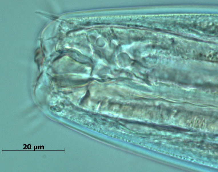 stoma